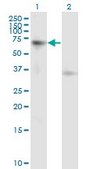 Monoclonal Anti-ACVR1B antibody produced in mouse clone 1C1, purified immunoglobulin, buffered aqueous solution