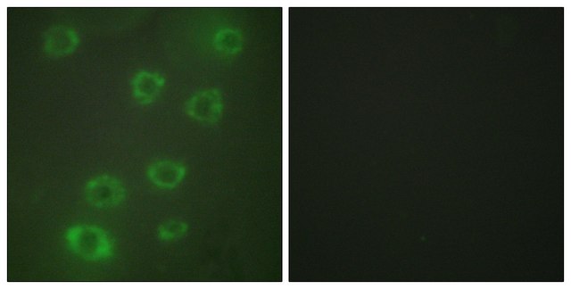 Anti-PTX3 antibody produced in rabbit affinity isolated antibody