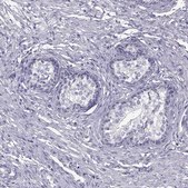 Anti-TNNC1 antibody produced in rabbit Prestige Antibodies&#174; Powered by Atlas Antibodies, affinity isolated antibody