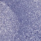 Anti-PTH1R antibody produced in rabbit Prestige Antibodies&#174; Powered by Atlas Antibodies, affinity isolated antibody, buffered aqueous glycerol solution