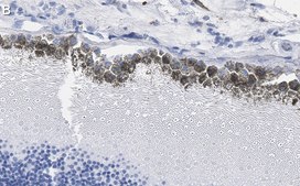 Anti-RPE65 Antibody, clone 2F8 ZooMAb&#174; Rabbit Monoclonal recombinant, expressed in HEK 293 cells