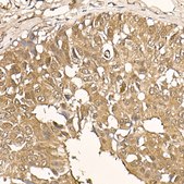 Anti-AKT1 Antibody, clone 10S9D6, Rabbit Monoclonal