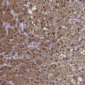 Anti-AKR1B1 antibody produced in rabbit Prestige Antibodies® Powered by Atlas Antibodies, affinity isolated antibody, buffered aqueous glycerol solution