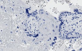 Anti-TBKBP1 Antibody, clone 3F13 ZooMAb&#174; Rabbit Monoclonal recombinant, expressed in HEK 293 cells