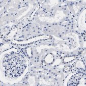 Anti-HLA-DQA1 antibody produced in rabbit Prestige Antibodies&#174; Powered by Atlas Antibodies, affinity isolated antibody, buffered aqueous glycerol solution