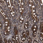 Anti-SPAST antibody produced in rabbit Prestige Antibodies&#174; Powered by Atlas Antibodies, affinity isolated antibody, buffered aqueous glycerol solution