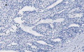 Anti-ATRX Antibody, clone 2A12, ZooMAb&#174; Rabbit Monoclonal recombinant, expressed in HEK 293 cells