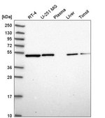 Anti-ILK antibody produced in rabbit Prestige Antibodies&#174; Powered by Atlas Antibodies, affinity isolated antibody
