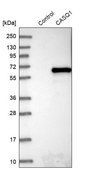 Anti-CASQ1 antibody produced in rabbit Prestige Antibodies&#174; Powered by Atlas Antibodies, affinity isolated antibody, buffered aqueous glycerol solution