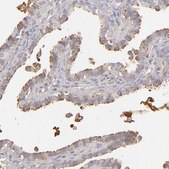Anti-ABCC4 antibody produced in rabbit Prestige Antibodies&#174; Powered by Atlas Antibodies, affinity isolated antibody, buffered aqueous glycerol solution