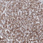 Monoclonal Anti-ABCD3 antibody produced in mouse Prestige Antibodies&#174; Powered by Atlas Antibodies, clone CL2524, purified immunoglobulin, buffered aqueous glycerol solution