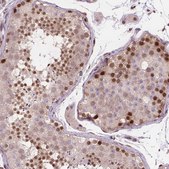 Anti-MGMT antibody produced in rabbit Prestige Antibodies&#174; Powered by Atlas Antibodies, affinity isolated antibody