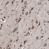 Anti-HSP90B1 antibody produced in rabbit Prestige Antibodies&#174; Powered by Atlas Antibodies, affinity isolated antibody, buffered aqueous glycerol solution