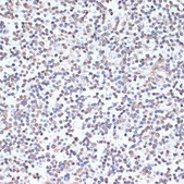 Anti-Phospho-PRKAA1-T183/PRKAA2-T172 antibody produced in rabbit