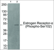 Anti-phospho-Estrogen Receptor-&#945; (pSer102) antibody produced in rabbit affinity isolated antibody