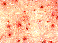 Anti-Nicastrin antibody produced in rabbit IgG fraction of antiserum, buffered aqueous solution