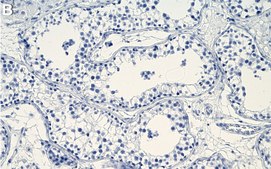 Anti-IKK&#949; Antibody, clone 1D7 ZooMAb&#174; Rabbit Monoclonal recombinant, expressed in HEK 293 cells