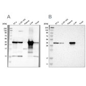 Anti-ACAA1 antibody produced in rabbit Ab2, Prestige Antibodies&#174; Powered by Atlas Antibodies, affinity isolated antibody, buffered aqueous glycerol solution