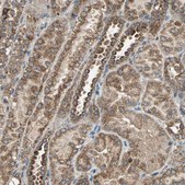 Anti-POLRMT antibody produced in rabbit Prestige Antibodies&#174; Powered by Atlas Antibodies, affinity isolated antibody, buffered aqueous glycerol solution