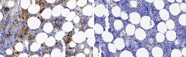 Anti-RANTES Antibody, clone 1K17 ZooMAb&#174; Rabbit Monoclonal recombinant, expressed in HEK 293 cells
