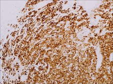 Inhibin, alpha (MRQ-63) Rabbit Monoclonal Antibody