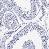 Anti-DPP4 antibody produced in rabbit Prestige Antibodies® Powered by Atlas Antibodies, affinity isolated antibody, buffered aqueous glycerol solution