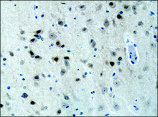 Anti-DSCR1 (C-terminal) antibody produced in rabbit ~1.5&#160;mg/mL, affinity isolated antibody, buffered aqueous solution