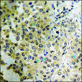 Anti-phospho-Stathmin 1 (pSer24) antibody produced in rabbit affinity isolated antibody