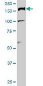 Monoclonal Anti-TOP2A antibody produced in mouse clone 1E2, purified immunoglobulin, buffered aqueous solution
