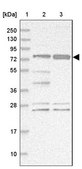 Anti-STIM2 antibody produced in rabbit Prestige Antibodies&#174; Powered by Atlas Antibodies, affinity isolated antibody, buffered aqueous glycerol solution