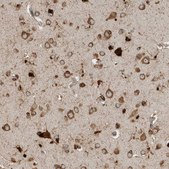 Anti-ATXN2 antibody produced in rabbit affinity isolated antibody, buffered aqueous glycerol solution, Ab3