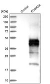 Anti-FCGR2A antibody produced in rabbit Prestige Antibodies&#174; Powered by Atlas Antibodies, affinity isolated antibody, buffered aqueous glycerol solution