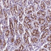 Anti-MRPL10 antibody produced in rabbit Prestige Antibodies&#174; Powered by Atlas Antibodies, affinity isolated antibody, buffered aqueous glycerol solution