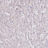 Anti-BARD1 antibody produced in rabbit Prestige Antibodies&#174; Powered by Atlas Antibodies, affinity isolated antibody, buffered aqueous glycerol solution