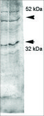 Anti-AQP4 antibody produced in rabbit 1&#160;mg/mL, affinity isolated antibody
