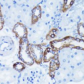 Anti-I&#954;B&#945; Antibody, clone 9H7X4, Rabbit Monoclonal
