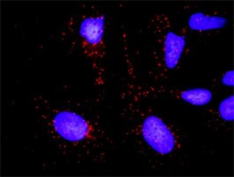 Anti-KLK3 antibody produced in rabbit purified immunoglobulin, buffered aqueous solution