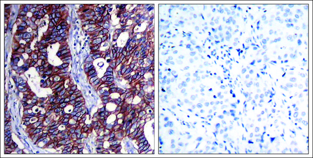 Anti-ERBB2 (Ab-1221/1222) antibody produced in rabbit affinity isolated antibody