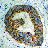 Anti-phospho-DDX3/DEAD-box Protein 3 (pThr322) antibody produced in rabbit affinity isolated antibody