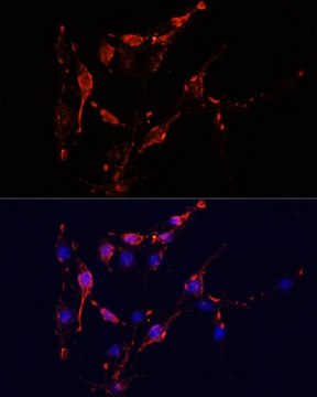 Anti-ICAM1 antibody produced in rabbit