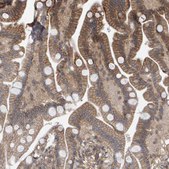 Anti-SCRIB antibody produced in rabbit Prestige Antibodies&#174; Powered by Atlas Antibodies, affinity isolated antibody, buffered aqueous glycerol solution