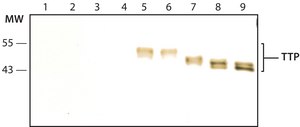 Anti-TTP (N-terminal) antibody produced in rabbit ~1.0&#160;mg/mL, affinity isolated antibody, buffered aqueous solution