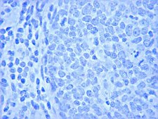 Anti-Ki-67 Antibody Chemicon&#174;, from rabbit