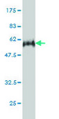 Monoclonal Anti-E2F6 antibody produced in mouse clone 1F7-A9, purified immunoglobulin, buffered aqueous solution
