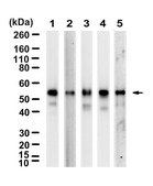 Anti-PEX14 Antibody, clone 1D7 ZooMAb&#174; Rabbit Monoclonal recombinant, expressed in HEK 293 cells