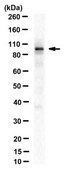 Anti-CTIP2/BCL11B Antibody, clone 25B6 clone 25B6, from rat