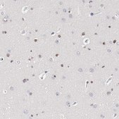 Anti-ZEB2 antibody produced in rabbit Prestige Antibodies&#174; Powered by Atlas Antibodies, affinity isolated antibody, buffered aqueous glycerol solution