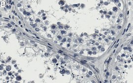 Anti-DNMT3B Antibody, clone 2N12 ZooMAb&#174; Rabbit Monoclonal recombinant, expressed in HEK 293 cells