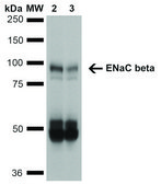 Monoclonal Anti-ENaC beta-Atto 594 antibody produced in mouse clone 7B8