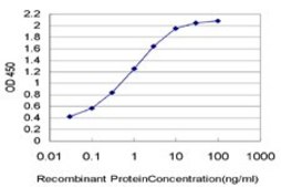Monoclonal Anti-UPK1B antibody produced in mouse clone 1E1, purified immunoglobulin, buffered aqueous solution